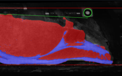 IBS1000 Vision Screen
